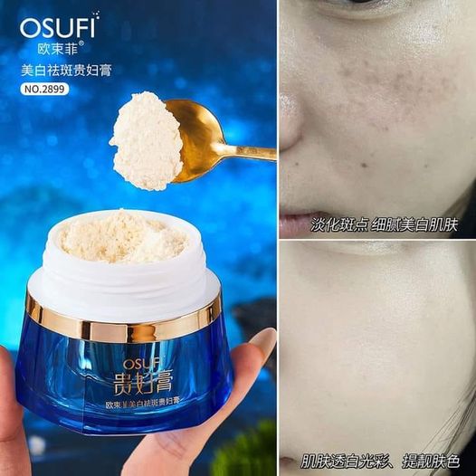 377 Osufi whitening Freckle Remiving Lady Cream