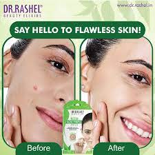 Dr Rasel Neem Acne Pimple Patch-36 patch