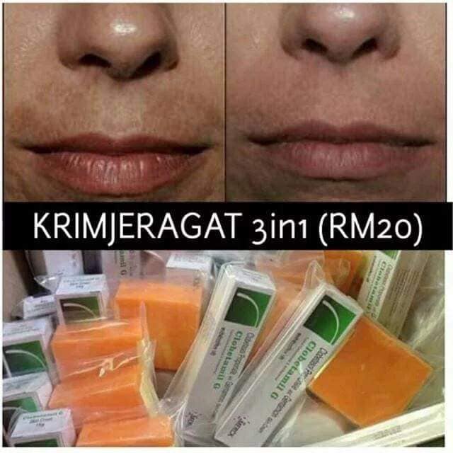 Clobetamil G Cream MESTA PAKAGE