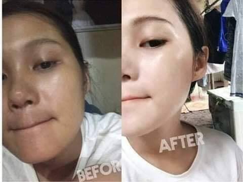 7 days Plastic Whitening Cream